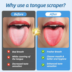 Alosalut 6 Pack Tongue Scrapers - Reusable & Easy to Clean Tongue Cleaner - Medical Grade Stainless  - Gold - U-Shaped (6 Count)